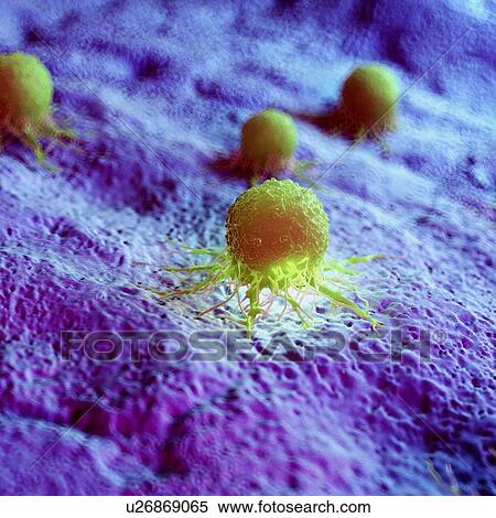 Stock Photography - Cancer cells, computer illustration.. Fotosearch