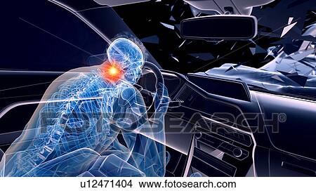 Car crash, computer illustration. View Large Photo Image Picture - Car crash, computer illustration.. Fotosearch