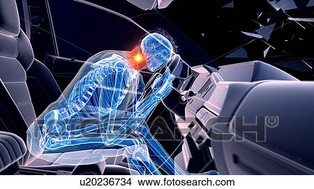 Car crash, computer illustration. View Large Photo Image Picture - Car crash, computer illustration.. Fotosearch
