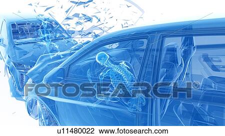 Car crash, computer illustration. View Large Photo Image Stock Image - Car crash, computer illustration.. Fotosearch