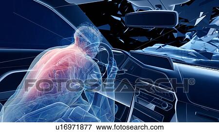 Stock Photo - Car crash, computer illustration.. Fotosearch