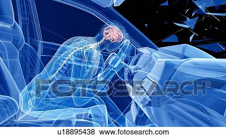 Car crash, computer illustration. View Large Photo Image Stock Photo - Car crash, computer illustration.. Fotosearch