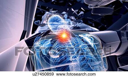 Stock Photo - Car crash, computer illustration.. Fotosearch