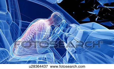 Stock Photo - Car crash, computer illustration.. Fotosearch