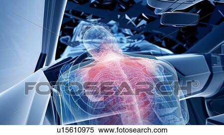 Car crash, computer illustration. View Large Photo Image Stock Photography - Car crash, computer illustration.. Fotosearch