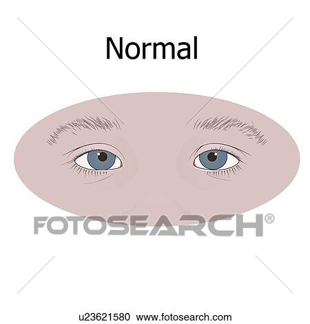 Child's eyes, illustration. View Large Photo Image Stock Image - Child's eyes, illustration.. Fotosearch