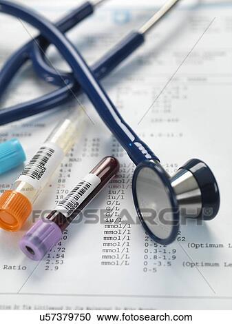 Clinical samples alongside test results and a stethoscope. View Large Photo Image Stock Image - Clinical samples alongside test results and a stethoscope.. Fotosearch