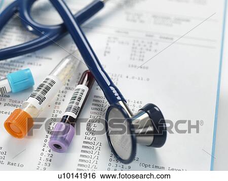 Stock Photograph - Clinical samples alongside test results and a stethoscope.. Fotosearch
