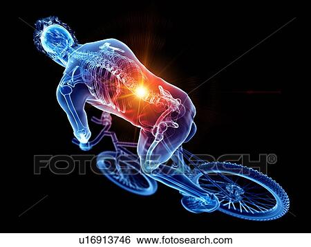 Stock Photograph - Cyclist with back pain, computer illustration.. Fotosearch
