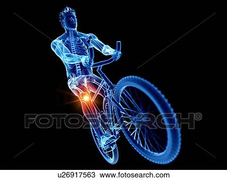 Stock Image - Cyclist with knee pain, computer illustration.. Fotosearch
