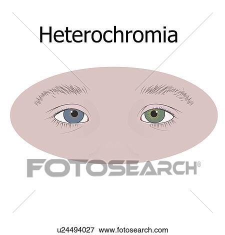 Stock Photo - Different coloured eyes, illustration.. Fotosearch