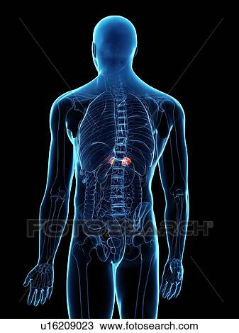 Stock Image - Diseased adrenal glands, conceptual illustration. Fotosearch