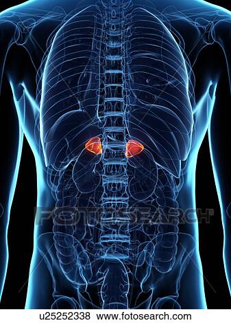 Stock Photo - Diseased adrenal glands, conceptual illustration. Fotosearch
