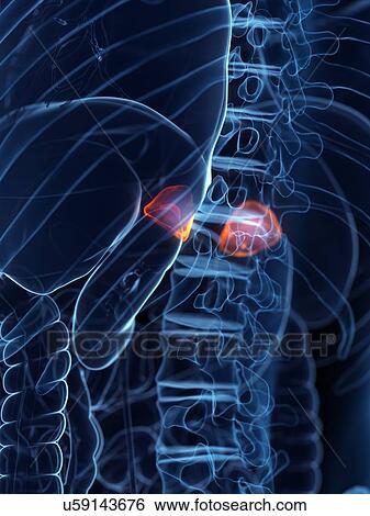 Stock Photograph - Diseased adrenal glands, conceptual illustration. Fotosearch