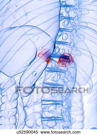 Stock Photography - Diseased adrenal glands, conceptual illustration. Fotosearch