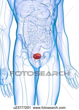 Diseased bladder, conceptual illustration View Large Photo Image Stock Image - Diseased bladder, conceptual illustration. Fotosearch