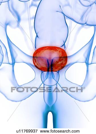 Diseased bladder, conceptual illustration View Large Photo Image Stock Photo - Diseased bladder, conceptual illustration. Fotosearch