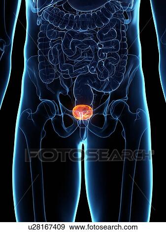 Stock Photo - Diseased bladder, conceptual illustration. Fotosearch