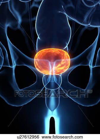 Diseased bladder, conceptual illustration View Large Photo Image Stock Photograph - Diseased bladder, conceptual illustration. Fotosearch