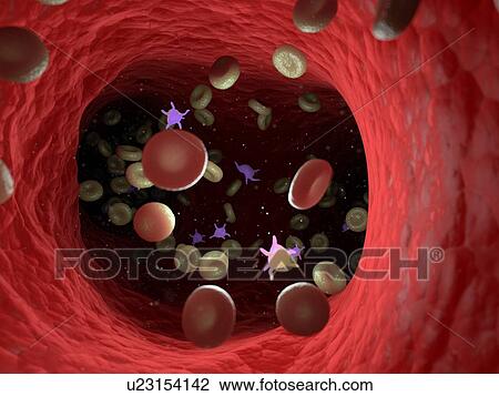 Diseased blood cells, computer illustration. View Large Photo Image Stock Image - Diseased blood cells, computer illustration.. Fotosearch