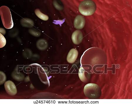 Diseased blood cells, computer illustration. View Large Photo Image Stock Image - Diseased blood cells, computer illustration.. Fotosearch
