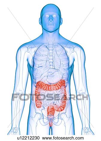 Stock Image - Diseased colon, conceptual illustration. Fotosearch