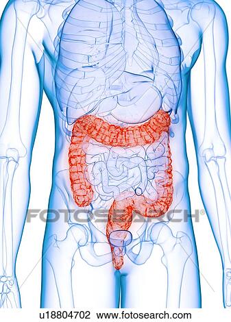 Stock Image - Diseased colon, conceptual illustration. Fotosearch