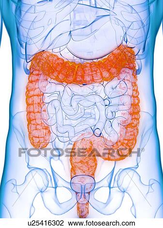 Stock Image - Diseased colon, conceptual illustration. Fotosearch