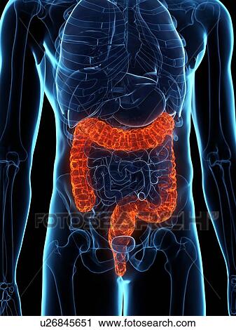 Diseased colon, conceptual illustration View Large Photo Image Stock Image - Diseased colon, conceptual illustration. Fotosearch