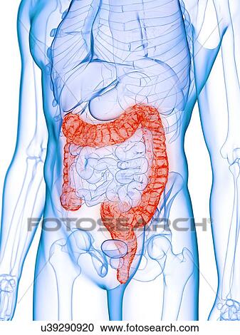 Stock Image - Diseased colon, conceptual illustration. Fotosearch