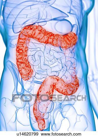 Diseased colon, conceptual illustration View Large Photo Image Stock Photo - Diseased colon, conceptual illustration. Fotosearch