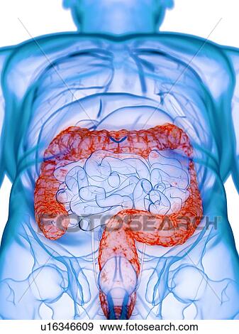Diseased colon, conceptual illustration View Large Photo Image Stock Photo - Diseased colon, conceptual illustration. Fotosearch