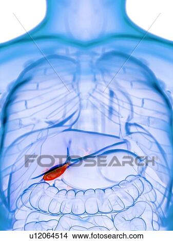 Diseased gallbladder, conceptual illustration View Large Photo Image Picture - Diseased gallbladder, conceptual illustration. Fotosearch