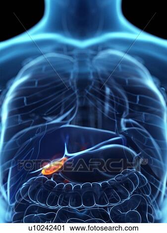 Diseased gallbladder, conceptual illustration View Large Photo Image Stock Image - Diseased gallbladder, conceptual illustration. Fotosearch