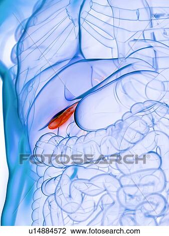 Stock Image - Diseased gallbladder, conceptual illustration. Fotosearch