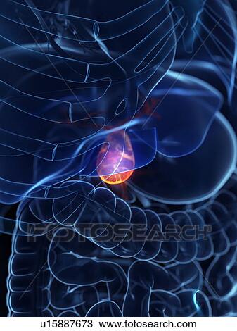 Diseased gallbladder, conceptual illustration View Large Photo Image Stock Image - Diseased gallbladder, conceptual illustration. Fotosearch