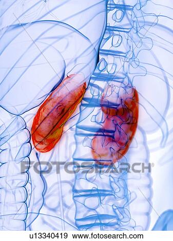 Stock Photo - Diseased kidney, conceptual illustration. Fotosearch