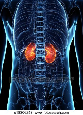 Stock Photo - Diseased kidney, conceptual illustration. Fotosearch