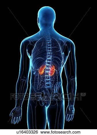 Stock Photograph - Diseased kidney, conceptual illustration. Fotosearch