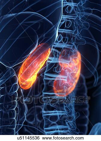 Diseased kidney, conceptual illustration View Large Photo Image Stock Photograph - Diseased kidney, conceptual illustration. Fotosearch
