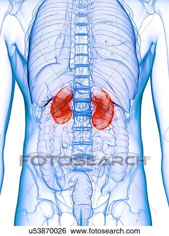 Stock Photograph - Diseased kidney, conceptual illustration. Fotosearch