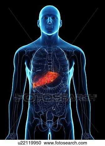 Stock Image - Diseased liver, conceptual illustration. Fotosearch