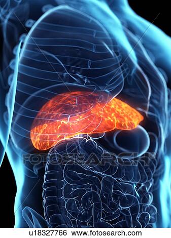 Diseased liver, conceptual illustration View Large Photo Image Stock Photograph - Diseased liver, conceptual illustration. Fotosearch