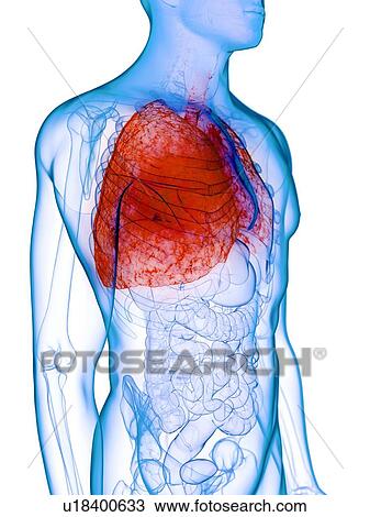 Stock Image - Diseased lung, conceptual illustration. Fotosearch