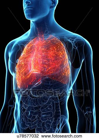 Stock Image - Diseased lung, conceptual illustration. Fotosearch
