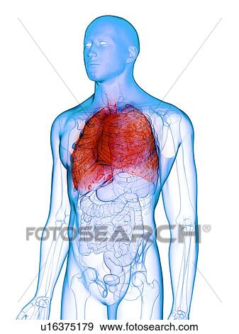 Stock Photo - Diseased lung, conceptual illustration. Fotosearch