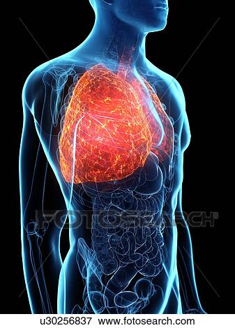 Stock Photo - Diseased lung, conceptual illustration. Fotosearch