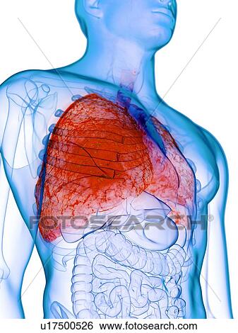 Stock Photograph - Diseased lung, conceptual illustration. Fotosearch