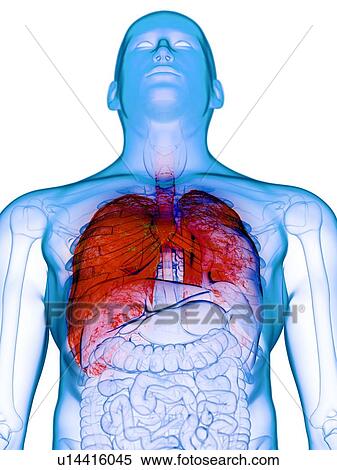 Stock Photography - Diseased lung, conceptual illustration. Fotosearch