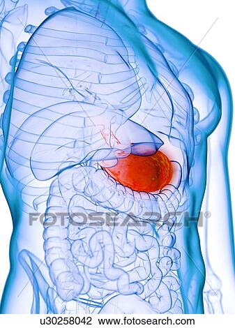 Stock Image - Diseased stomach, conceptual illustration. Fotosearch